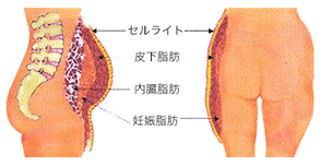 body3_03ds_03